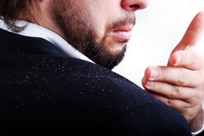 8 Effective Tips to Prevent Dandruff This Winter