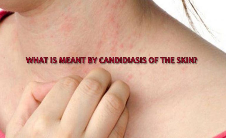 What is meant by candidiasis of the skin?
