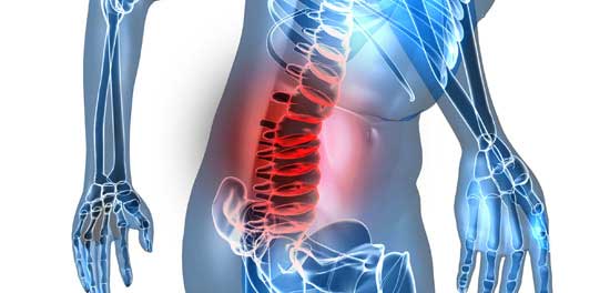 Home Remedies to relieve From Back Spasms