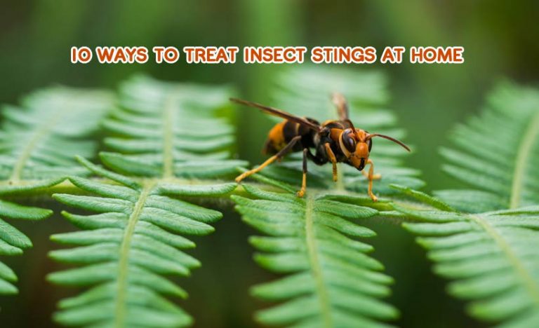 10 Ways to Treat Insect Stings at Home