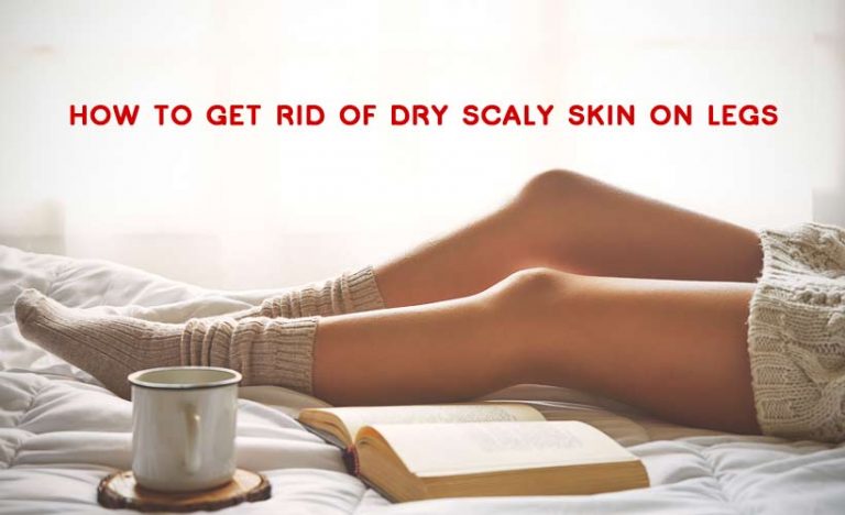How to Get Rid of Dry Scaly Skin on Legs
