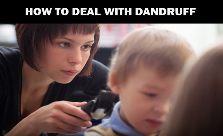 How to deal with dandruff?