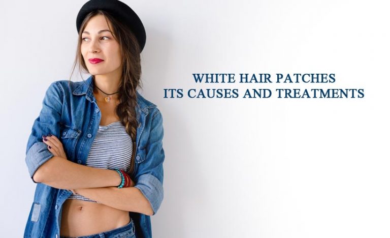 White Hair Patches- Its Causes and Treatments