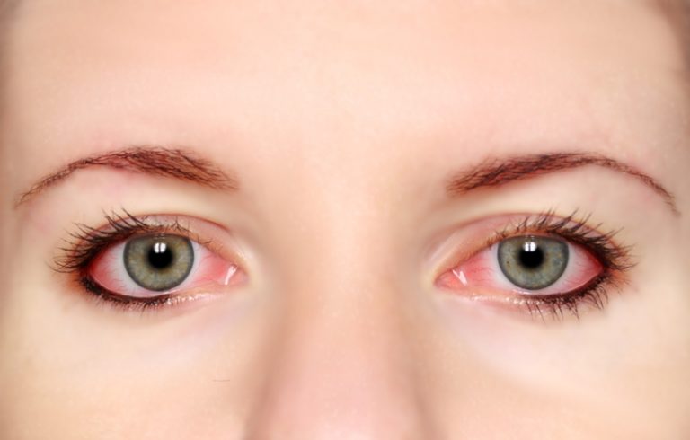 25 Tips To Take Care Of Your Beautiful Eyes Daily