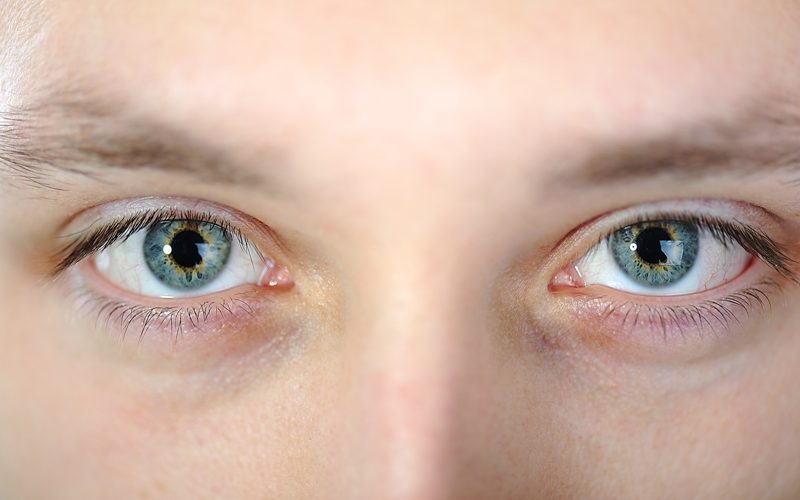 What Is Computer Vision Syndrome? What Is Computer Vision Syndrome?
