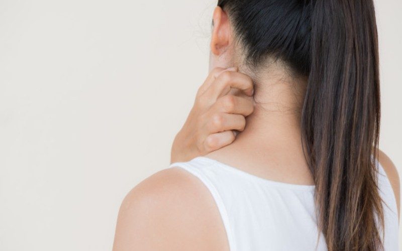Differences between eczema and psoriasis Differences between eczema and psoriasis