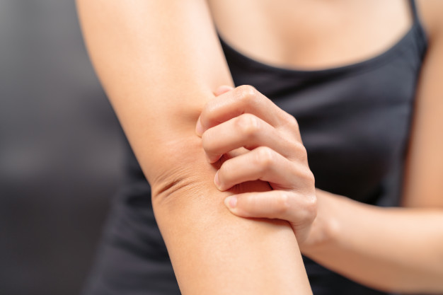 Differences between eczema and psoriasis