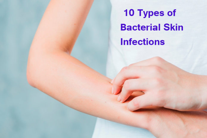 10 Types of Bacterial Skin Infections