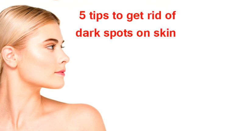 5 tips to get rid of dark spots on skin