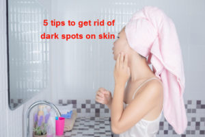 5 tips to get rid of dark spots on skin