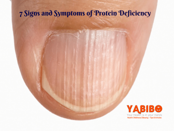 protein deficiency test at home