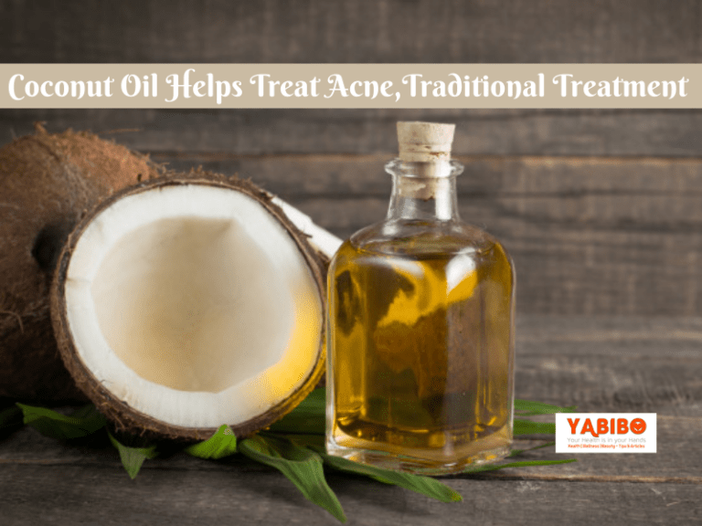 Coconut Oil Helps Treat Acne,Traditional Treatment