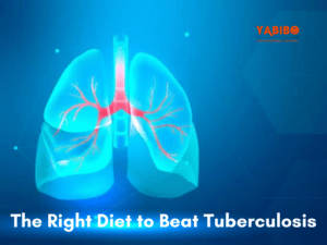 The Right Diet to Beat Tuberculosis