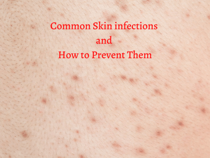 Common Skin infections and How to Prevent Them