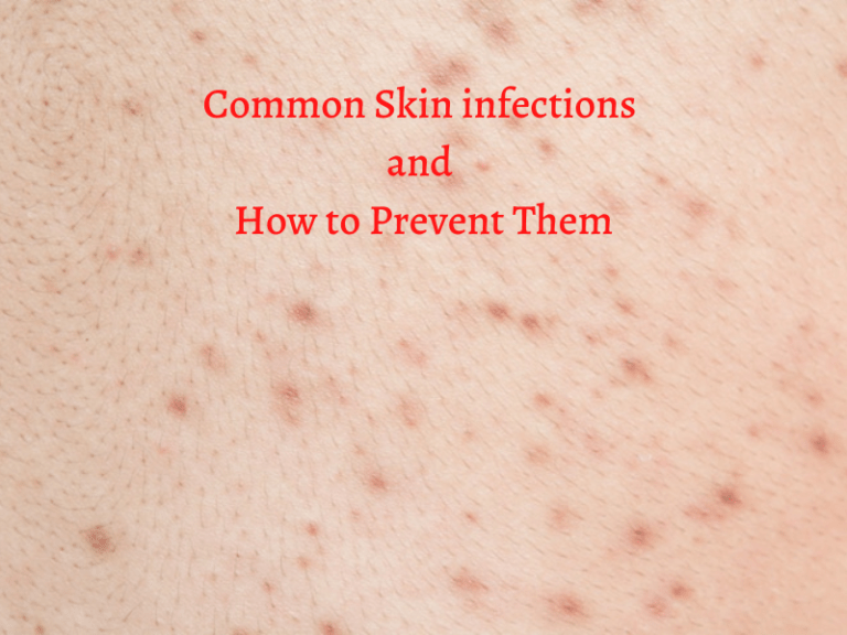 Common Skin infections and How to Prevent Them