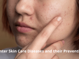 Winter Skin Care Diseases and their Prevention