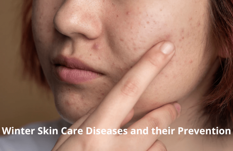 Winter Skin Care Diseases and their Prevention