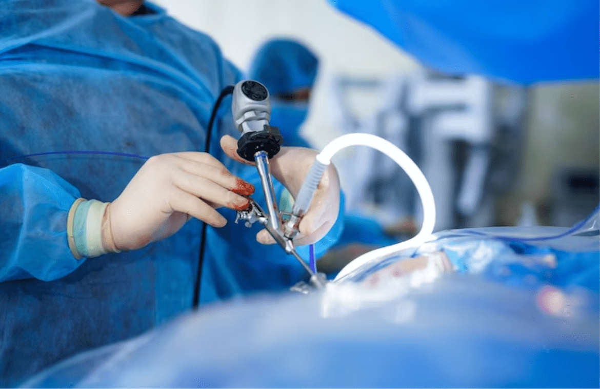 Stenting Surgery: It's functioning and effectiveness Stenting Surgery: It's functioning and effectiveness